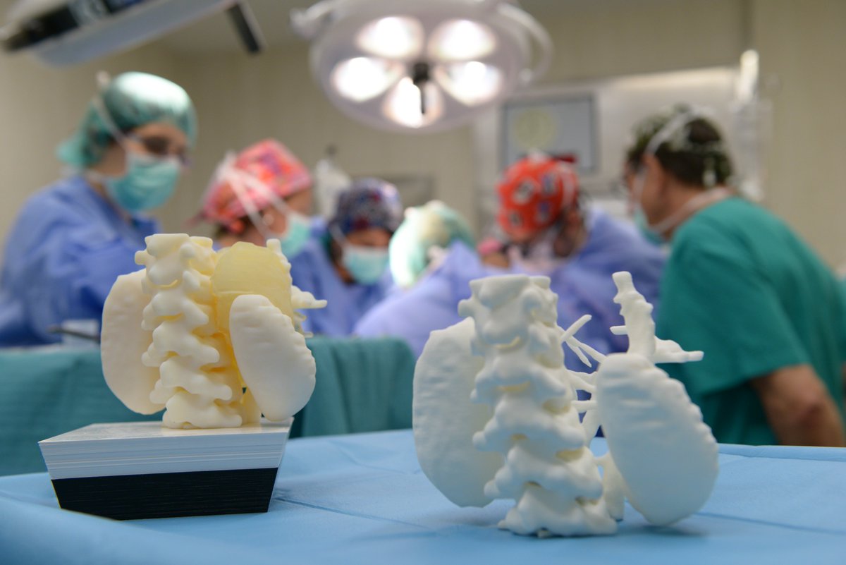 bcn3dtech's tweet photo. @SJDbarcelona_es hospital has printed the model of a tumor to practice the surgery of its extraction. Happy to help in this cases too! https://t.co/EGH9C1qoYV