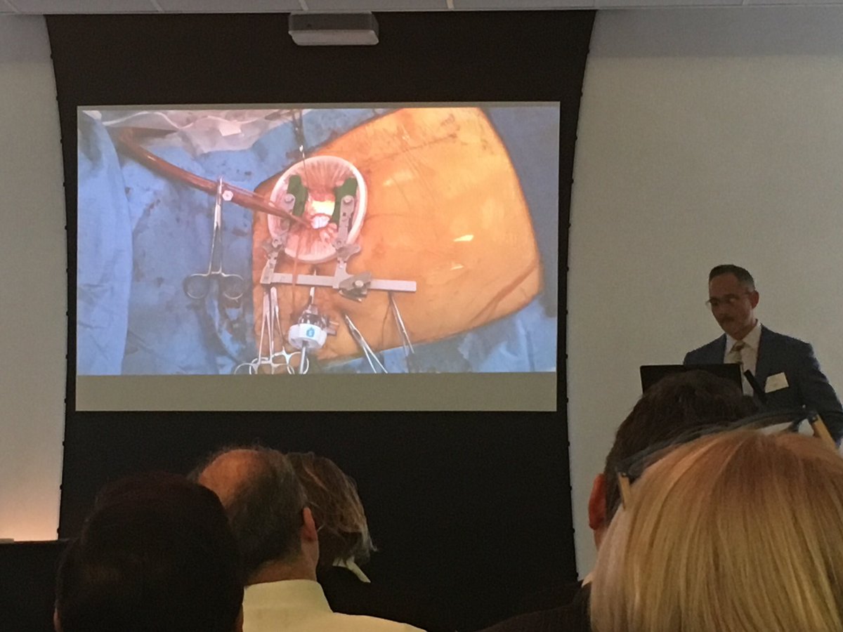 drkirmani's tweet photo. Inspiring talk from industry: #innovation helps us transfer #pain from the #patient to the #surgeon; #industry transfers it from the surgeon to the #technology. #keyhole #heartsurgery #LSIsolutions @BISMICS https://t.co/gyVvBnPO8M