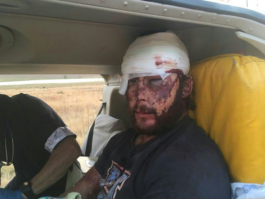 crabracer's tweet photo. @ArthurCrismach @ExpoFanie South African farmer Arendt Corbett before and after the savage #FarmAttack yesterday https://t.co/UiVD4Vb87E