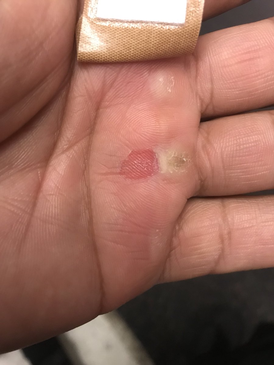Soooo I guess this is what they mean by no pain no gain!!! Great workout out but frustrated I should be leaner and stronger by this point. Grrrrr!! I’ll still keep grinding don’t you worry. Have a great day everyone