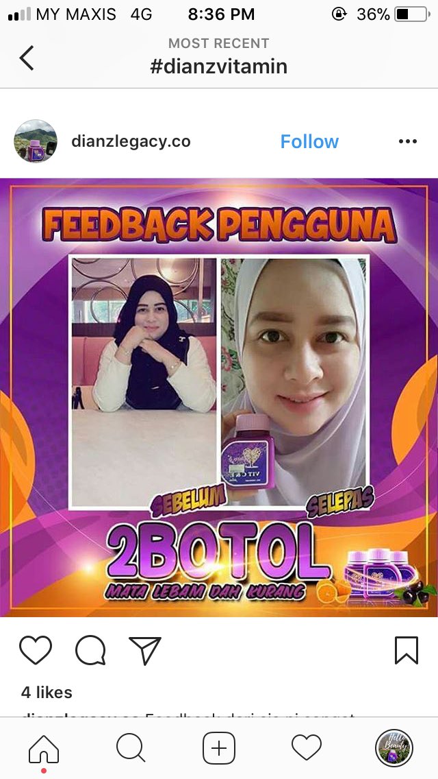 dianz_vit's tweet photo. yang nak hilangkan jerawat, jeragat, parut lama, exzema, putihkan kulit boleh guna #dianz vit. mmg tak rugi.
📱 : https://t.co/xusRK0abCd https://t.co/HsDnyknO4p