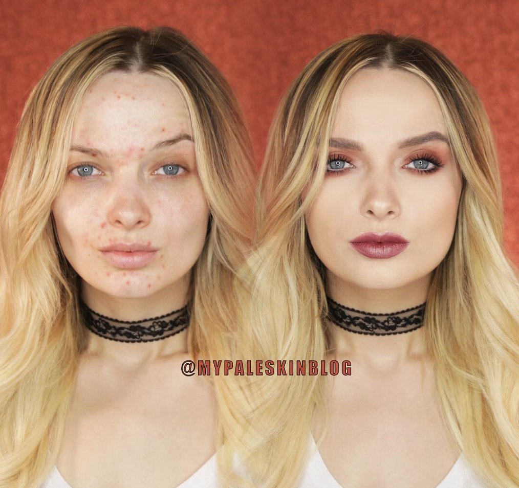 celebmuamaster's tweet photo. Our #bloggercrush today is @mypaleskinblog ❤️ We love her honest before and after shots.
-
#Repost @mypaleskinblog https://t.co/14HiSVyfbF