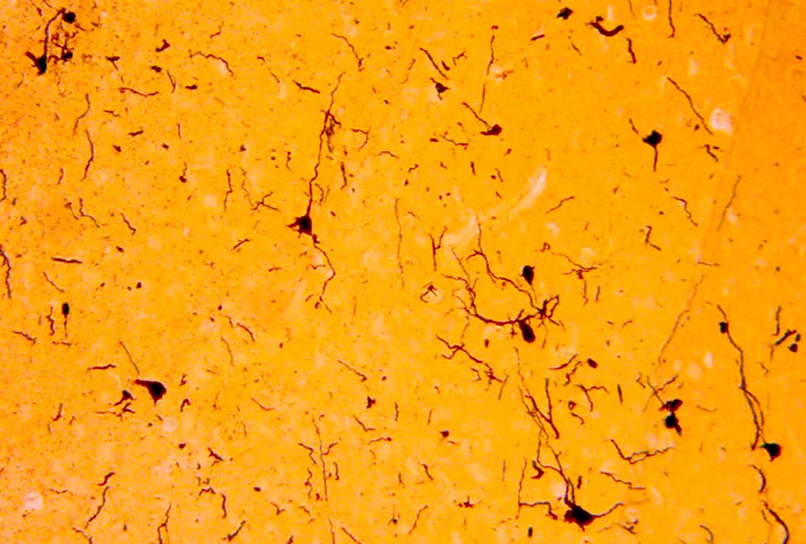 fjesteban's tweet image. #neurons #microscopy #labSession @ujaen @UJABio #CellBioHistoUJA