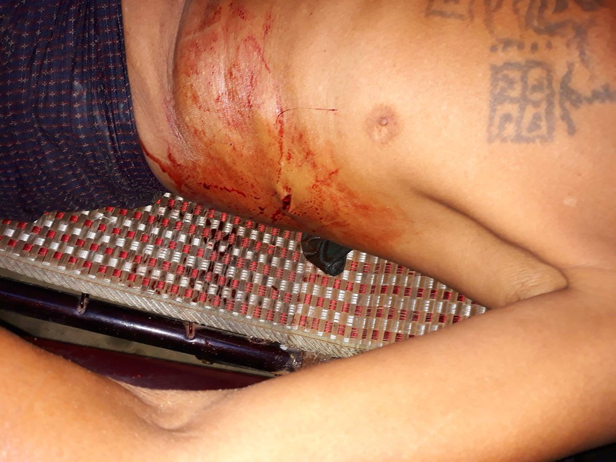 7 local men violently attacked by #Bengali (aka #Rohingya) mobs in #Rakhine, #Myanmar. 1 critically wounded. 11-03. <a href="/BBCWorld/">BBC News (World)</a> <a href="/CNNi/">CNN International</a> <a href="/AP/">The Associated Press</a>