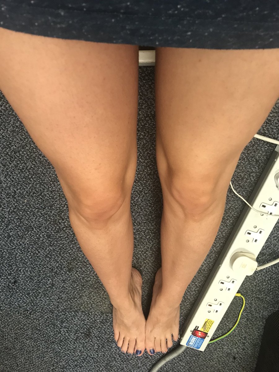 JayModeling's tweet photo. Oh. My. God. Is that a tan I see on myself ?!?! What is this craziness. #casper  #lifeofaghost https://t.co/08c5q4HQz1