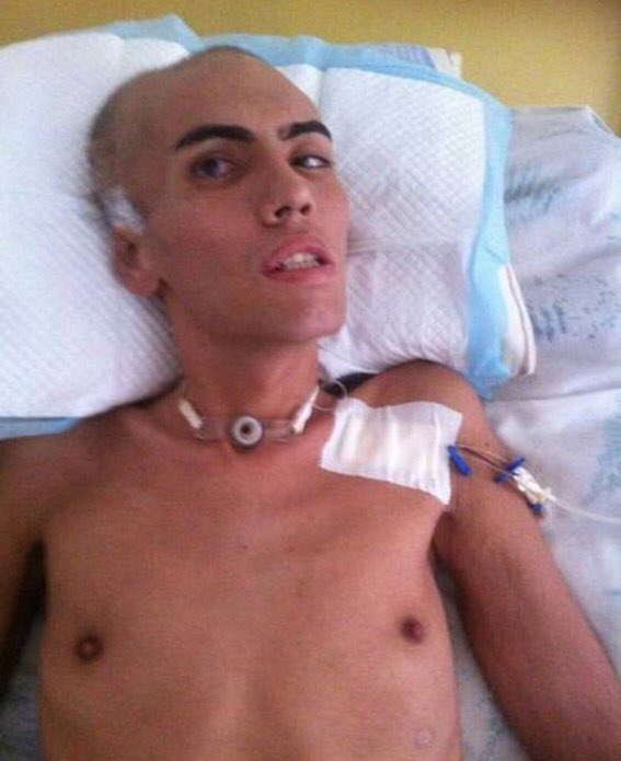 Birrilly's tweet photo. (((RECUPERÁNDOSE))) Gracias a todas las personas que colaboraron con #AngeloQuintero se logró la intervención y le colocaron la válvula Y ESTA EN FRANCA RECUPERACIÓN, pero aún requiere ayuda para el postoperatorio @ReporteYa @AnonymissNegra @TemplarioResisT @IndignadosVezla https://t.co/TBuSyF2iid