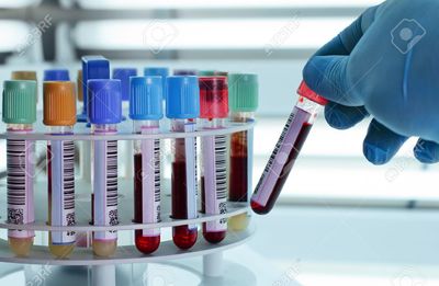 UdeelsHyderabad's tweet photo. 25% OFF | Discount on diagnostic tests billing | #UniversalDiagnostics | #Health | #Kukatpally | #Hyderabad
https://t.co/dvENkM2YG6 https://t.co/FtGUxnay0W