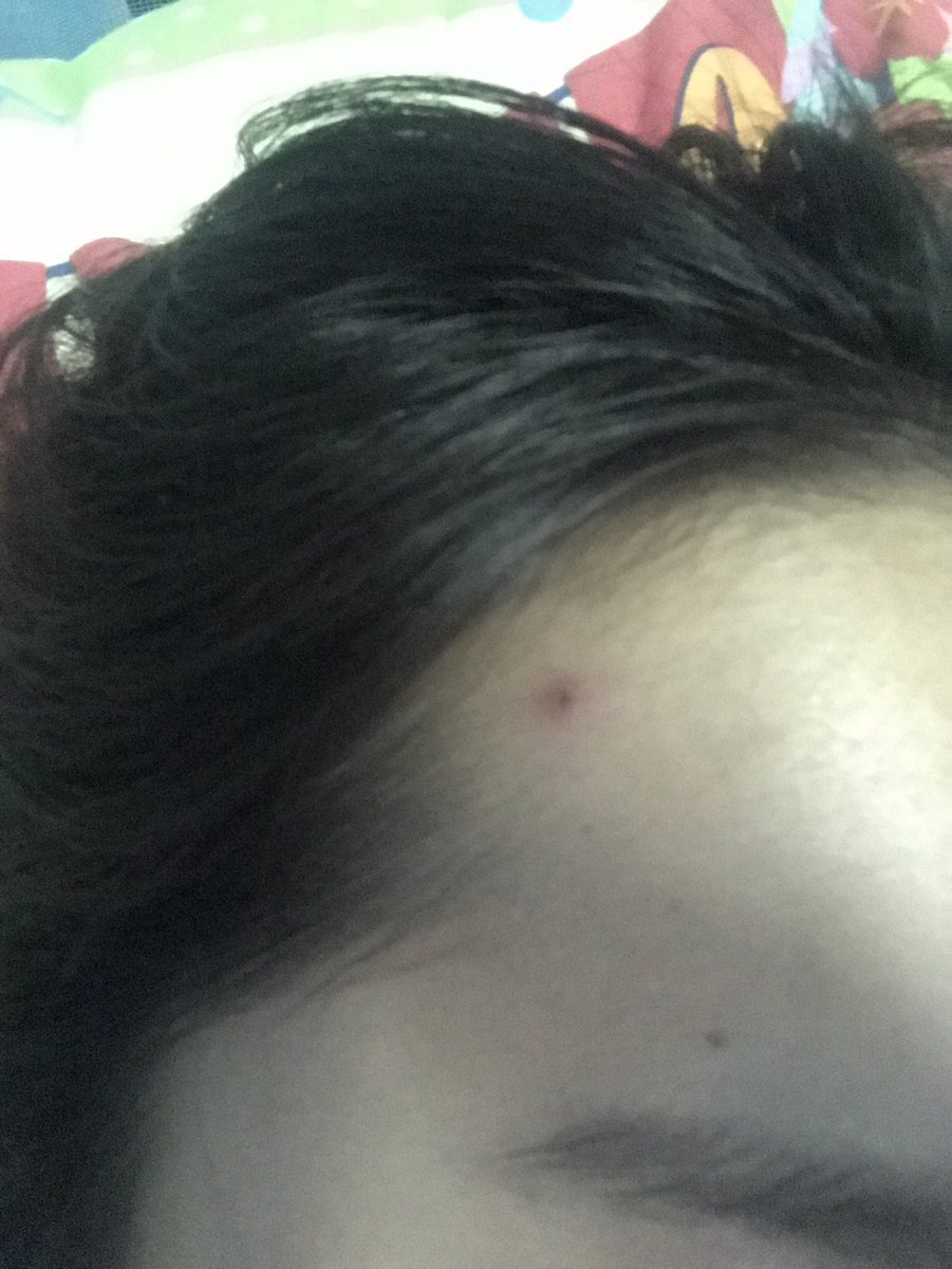 Iamaomam_'s tweet photo. คืนเดียวรู้เรื่อง จากสิวที่กำลังอักเสบอยู่ตื่นมาก็ยุบลงจ้า คือตกใจมากเป็นเจลบำรุงที่เริ่ดสุดๆ 180฿เองไปตำใช้ได้นานมากๆ  #ใช้จริงรีวิวจริง https://t.co/0Nzr718XBm