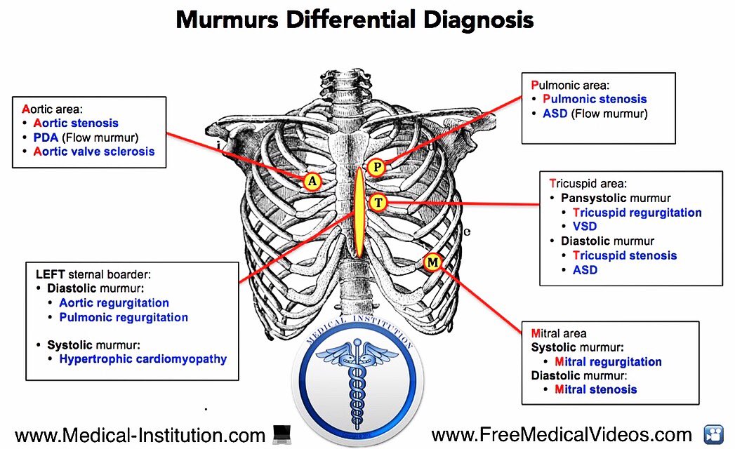 Medical Institution On Twitter Common Locations Of Different ️ 