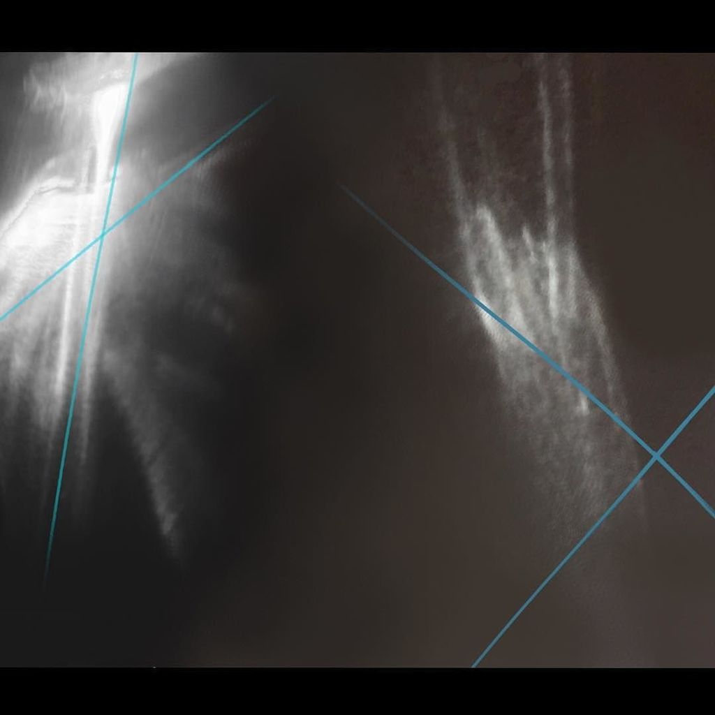 wynn_wolfe's tweet photo. “X-Centric Entities 3 &amp; 4 (Fraternal Twins)” #eccentric #X_unknown #twins #geo_centric #helio_centric #light_entities #once_and_future_kings #higher_self #golden_man_in_silver_mirror  #guides #Theodidactus_and_Cosmiel #two_guides #drawing #digital #iphon… https://t.co/X6wljPAe0R https://t.co/hhge71nJ0A