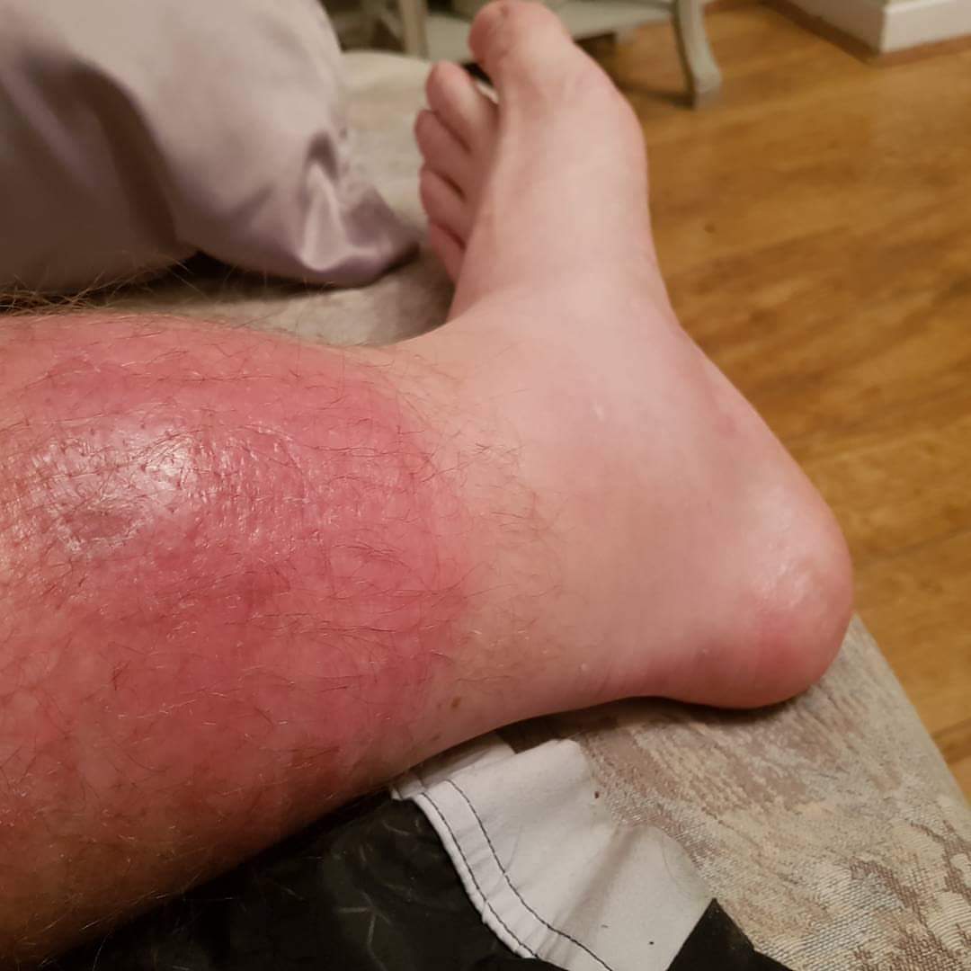 HYCRFC's tweet photo. Do not walk pets on sports fields #dogshit #WRU #Rugby #pain Good luck Mikey! https://t.co/zOFwgXfZOD