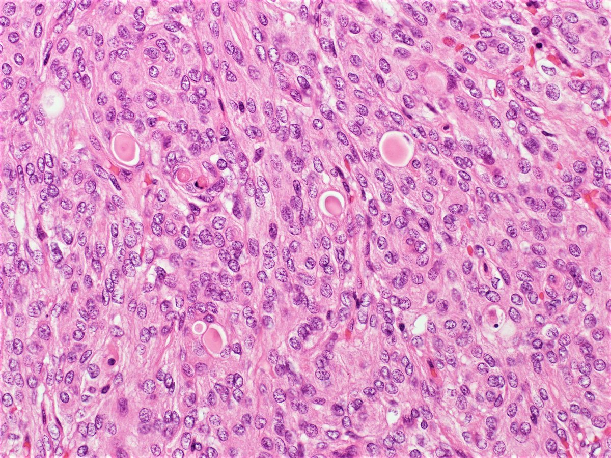 Поперечно-полосатая скелетная мышечная ткань гистология. Колибактериоз кроликов микроскопия. Гистология кролика. Однослойный призматический (цилиндрический) эпителий гистология. Гистология кролика.
