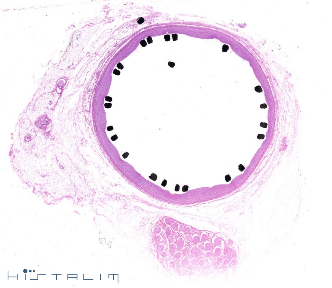 HISTALIM tweet media