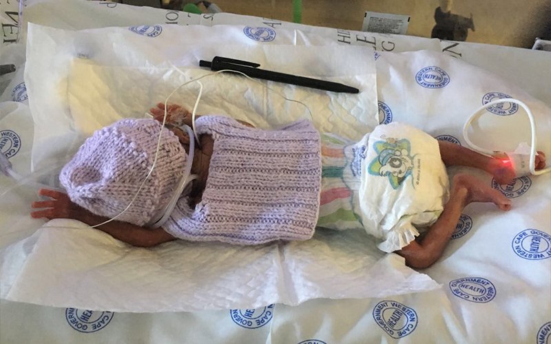 RelateBracelets's tweet image. MoM Project enabling preemies to have access to milk relate.org.za/news/mom-proje… #Purple4Preemies #WorldPrematurityDay