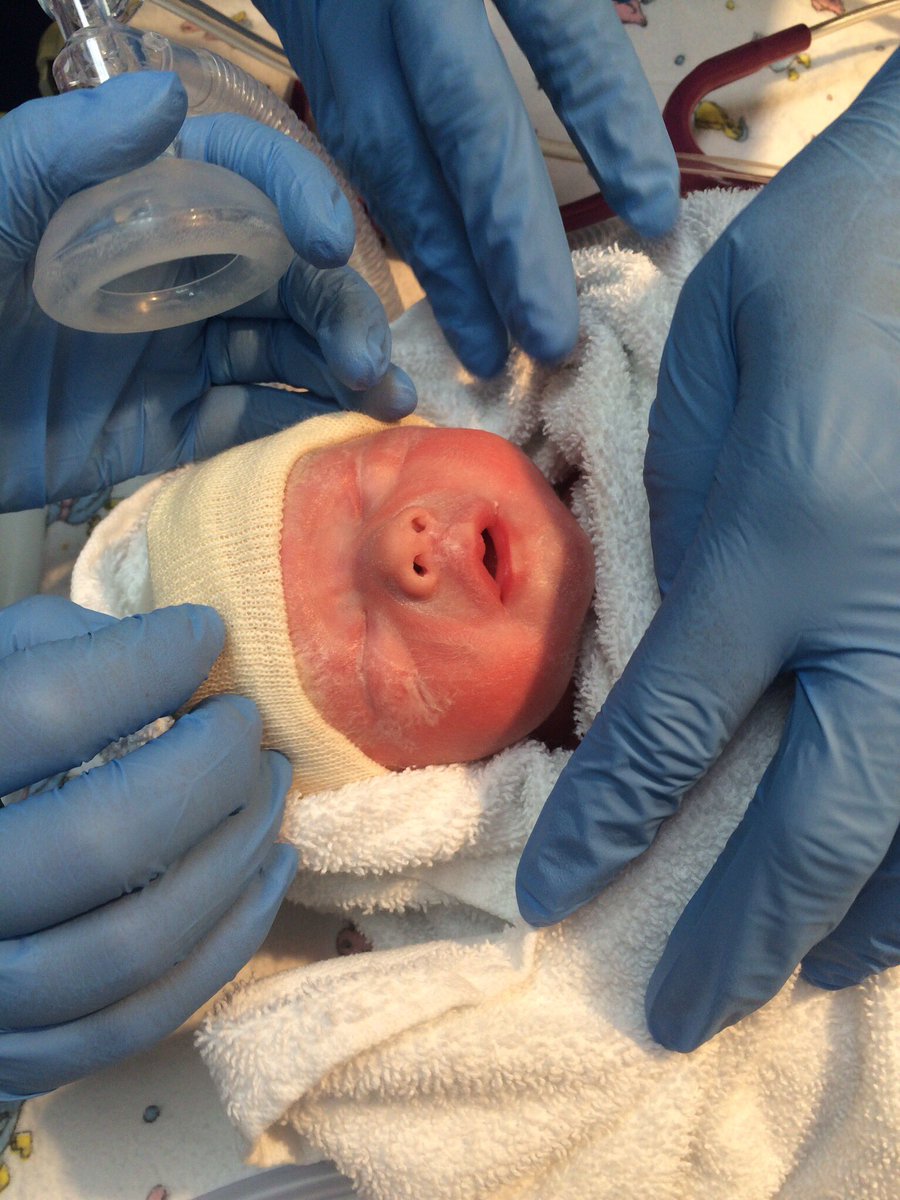 heatingsheff's tweet photo. Happy World Prematurity day - My little girl Darcey was born at 24 weeks &amp; my son Teddy at 32 weeks - look at them now @Blisscharity @NHSEngland @SheffChildrens #Prematurityls thank you to all the hard work &amp; effort to keep my children alive https://t.co/qdb7eDiJlr