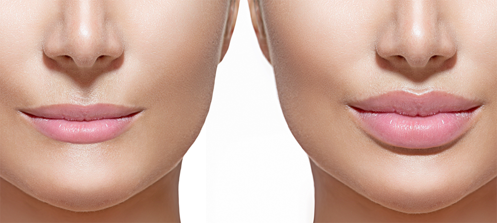 InfoMmedisystem's tweet photo. Αυξητική χειλιών με υαλουρονικό για να αποκτήσετε άψογα χείλη. Αυξήστε το μέγεθος των χειλιών σας από 99€
https://t.co/LoMjXDub9w https://t.co/utqUZdhd9o