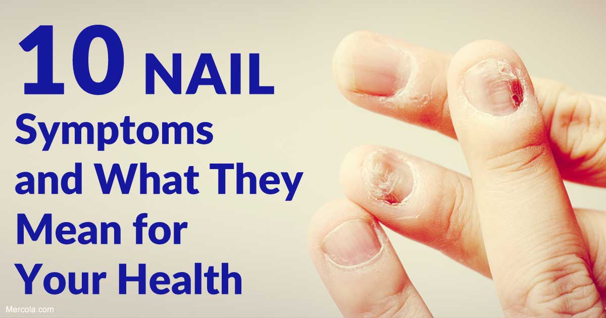 YvonneDuffeDO's tweet photo. 10 Nail Symptoms and What They Mean for Your #Health #NailHealth #NailSymptoms https://t.co/oqn0iQLwGl https://t.co/E4ubV5KiLe