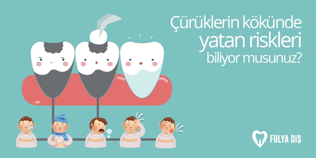 Diş Çürüğü ve Önleme Yöntemleri yazımızı okumak için tıklayınız: bit.ly/2mCzsJX