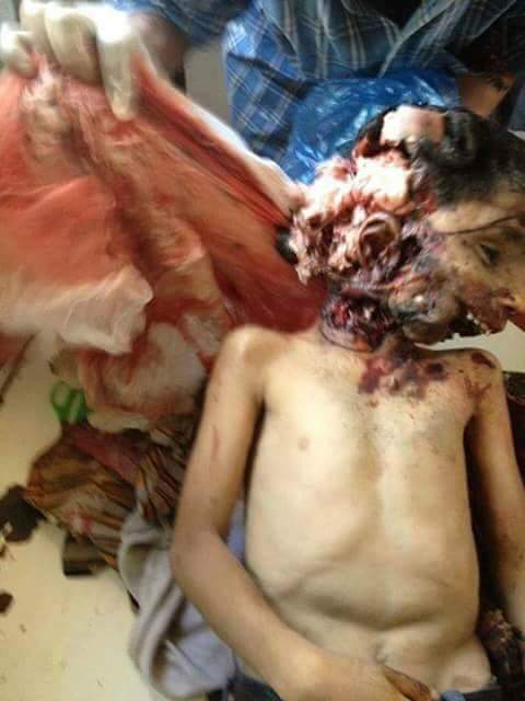 جرائم آل سعود في اليمن