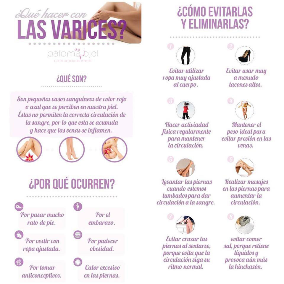 Dra_PalomaOjel's tweet photo. ¿#Sabíasque estamos en la mejor época del año para tratar las varices? Esas pequeñas venitas que salen en nuestras piernas y provocan hinchazón, dolor y cansancio... 
¡Conoce nuestro #TratamientoCorporal de #EsclerosisdeVarices! #FelizViernes #MedicinaEstética https://t.co/7Zav6xN6tG