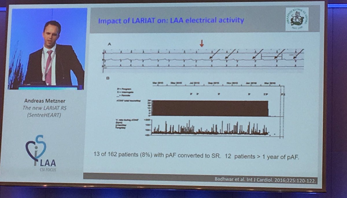 amazetrial's tweet photo. Dr. Andreas Metzner presenting safety data and LAA electrical isolation benefits of the new LARIAT RS #CSILAA17 @CSIcongress. https://t.co/2YwO28nUoI