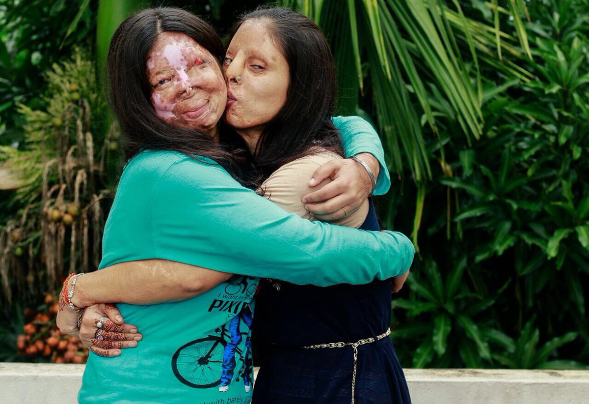 StopAcidAttacks's tweet photo. #Shedreamsagain 

@SheroesHangout @StopAcidAttacks @tweettosheroes https://t.co/dBmsAbYEyL