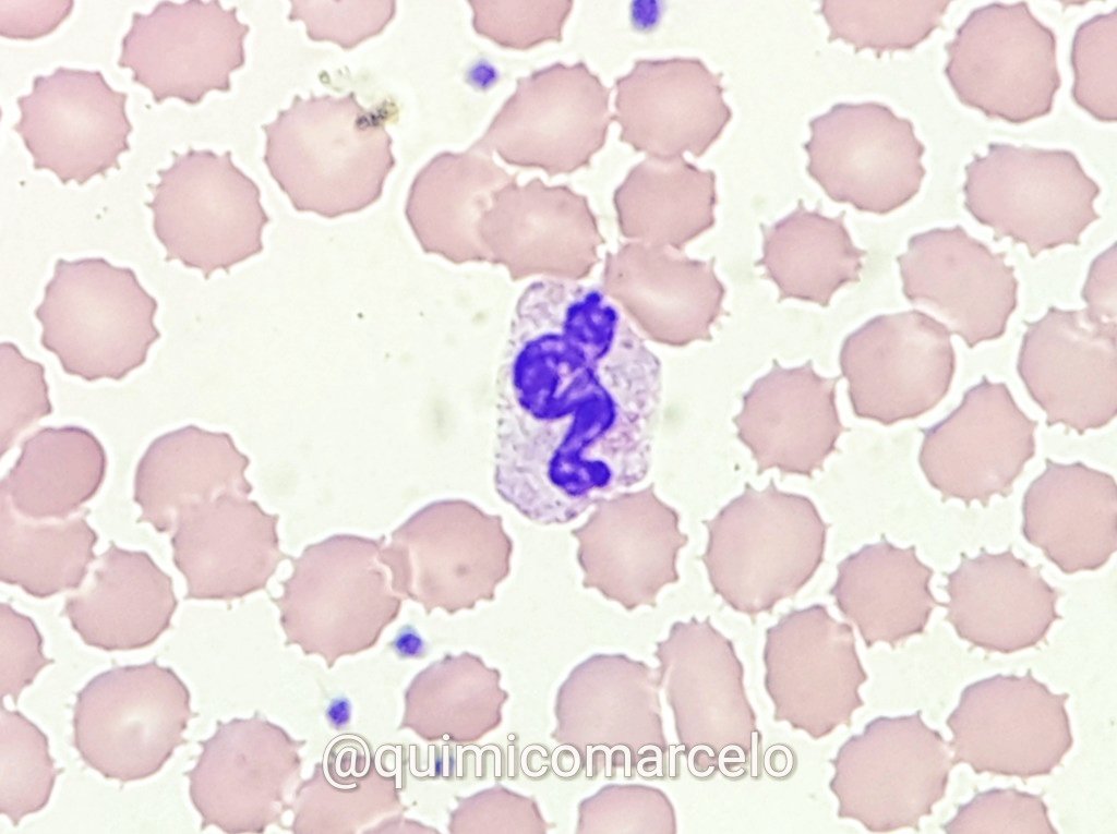 QuimicoMarcelo's tweet photo. Alone in a casual day, and waiting for a bacteria. @kmirza @rabiaahmad3 @TeamHaem #hemapath https://t.co/dhXqhal85V