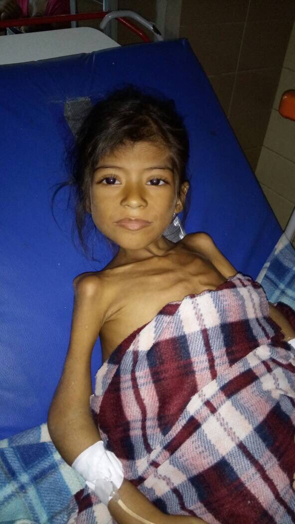 Cuando las fotos de niños desnutridos que observamos ya no son del África si no nuestros Eso es el socialismo, hambre, muerte y desolación