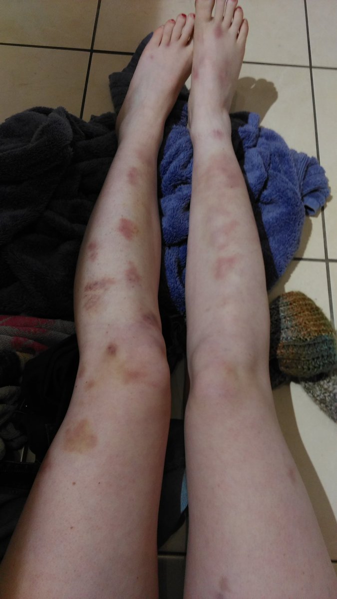 WomaninHolocene's tweet photo. I think that's enough kicking for one week. #muaythai #conditioning https://t.co/6oUhwLq7Lh