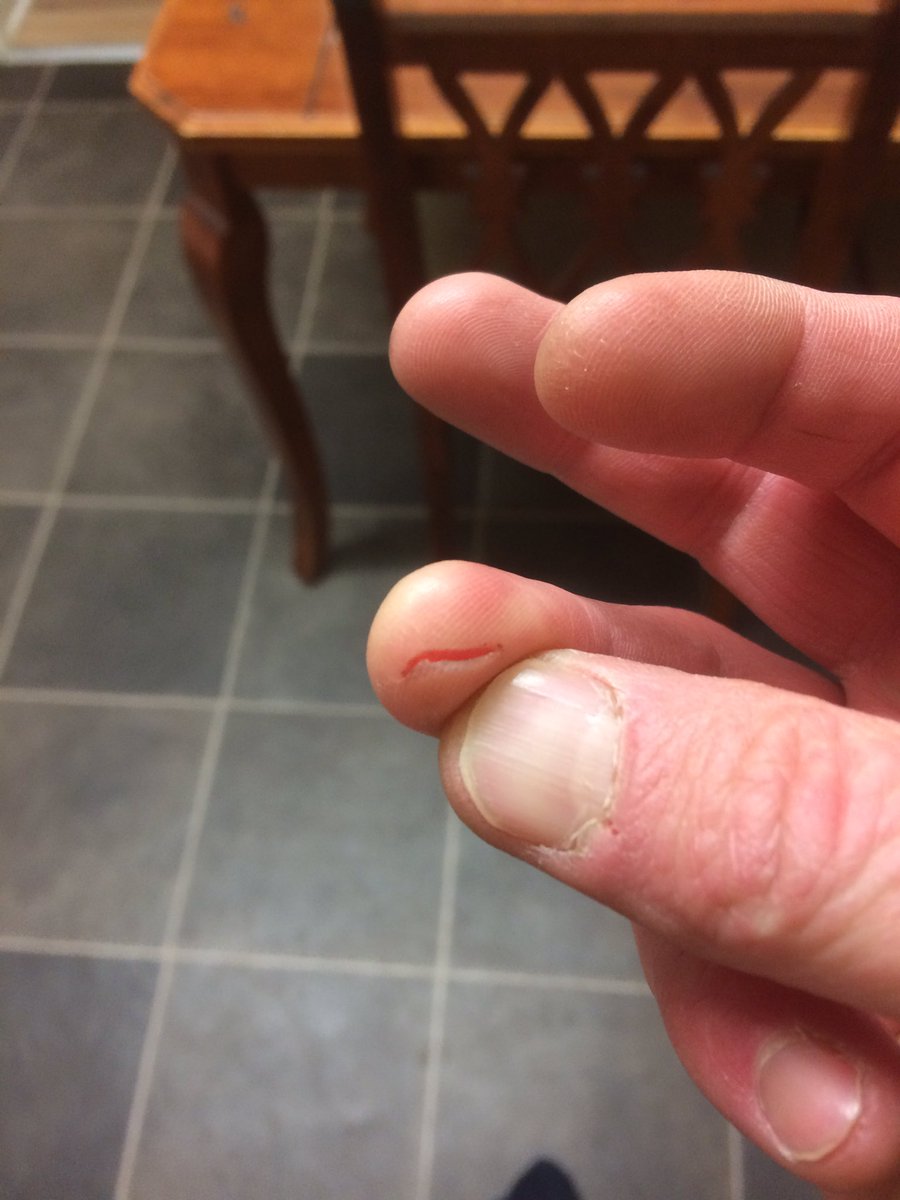 PerringMatthew's tweet photo. Angry one , it bit me lol https://t.co/k93w4gtDtl
