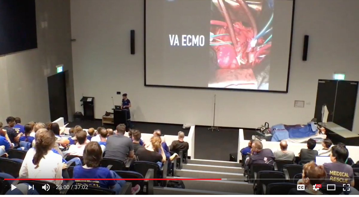 M Velia Antonini (@foamecmo) on Twitter photo Management of the VV & VA #ECMO patient Dr Natalie Kruit <a href="/GomorraDoc/">Sean Scott</a> <a href="/learnECMOteam/">learnECMOteam</a> <a href="/SydneyHEMS/">SydneyHEMS</a> #ECLS #ECPR #FOAMed #FOAMcc youtube.com/watch?v=bxX2YR… Management of the VV & VA #ECMO patient Dr Natalie Kruit <a href="/GomorraDoc/">Sean Scott</a> <a href="/learnECMOteam/">learnECMOteam</a> <a href="/SydneyHEMS/">SydneyHEMS</a> #ECLS #ECPR #FOAMed #FOAMcc youtube.com/watch?v=bxX2YR…