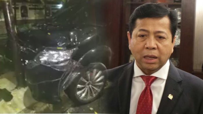 listychan99's tweet photo. Pengacara : Setya Novanto Diperiksa Oleh 5 Dokter RSMC https://t.co/dK3LRR7U1B https://t.co/M33Q1Ai8J3