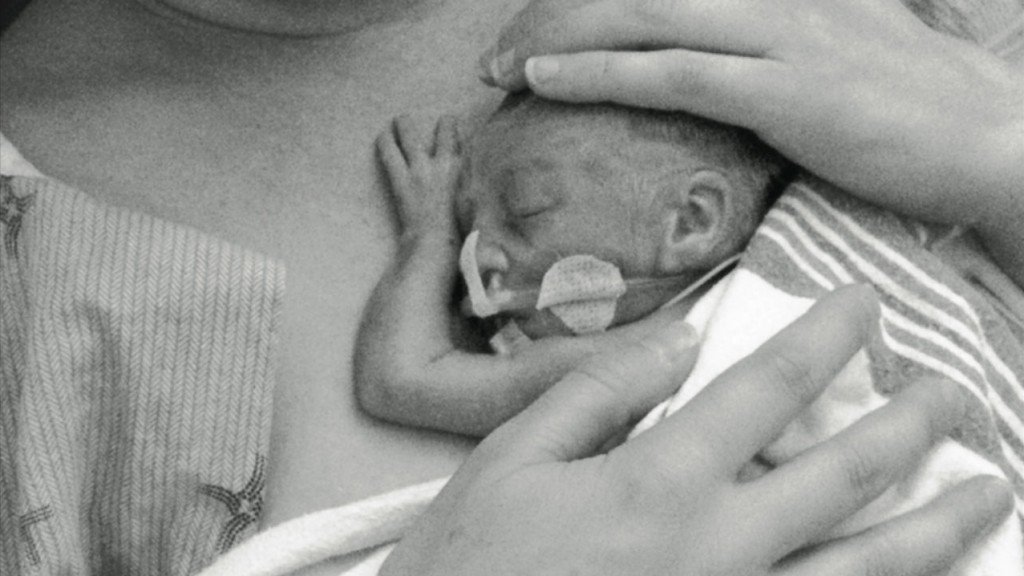 ElleLindquist's tweet photo. Yesterday was #WorldPrematurityDay, and if you have a preemie, this excellent article will help you navigate the #NICU and everything after. —> https://t.co/QkJuRiI5Wt @Todaysparent
#PrematurityAwarenessDay #prematurityawareness #WorldPrematurityDay #WPD17 https://t.co/PRivbDnnii