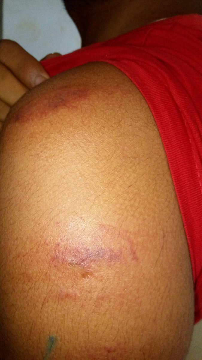 Nit Manipur student tweet media