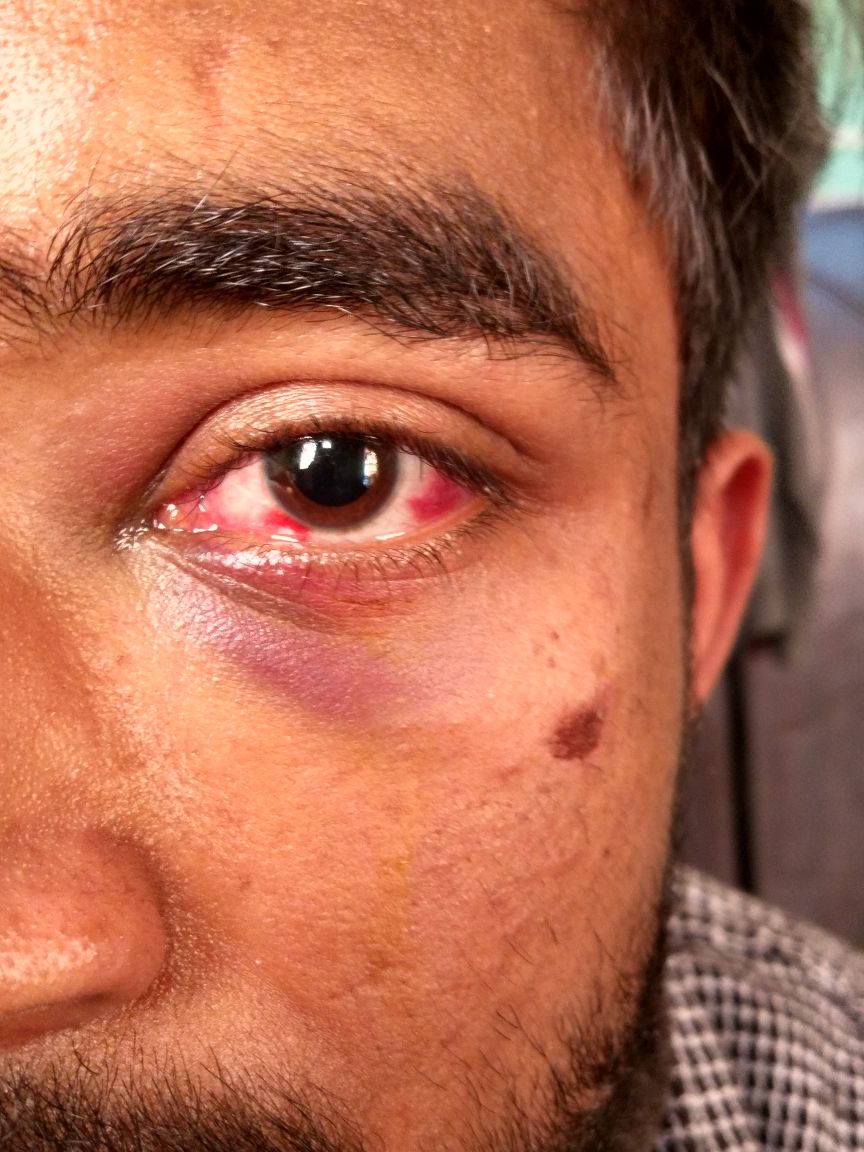 Nit Manipur student tweet media