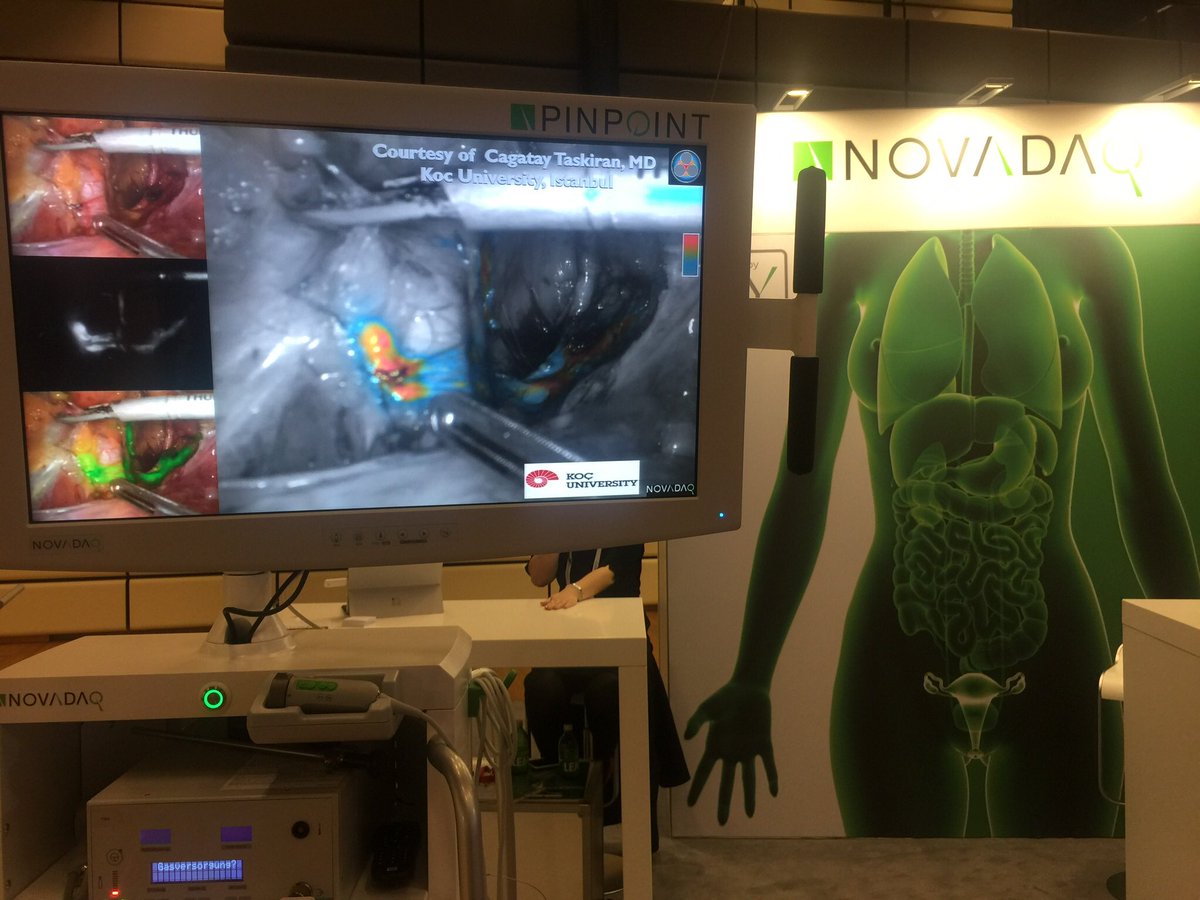 cerrahitv's tweet image. #ESGO2017 @NOVADAQTech #8