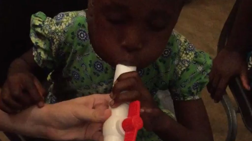 BBCAfrica's tweet photo. Malaria breath test shows promise https://t.co/aoUhQz7cKv https://t.co/KuD04h3554