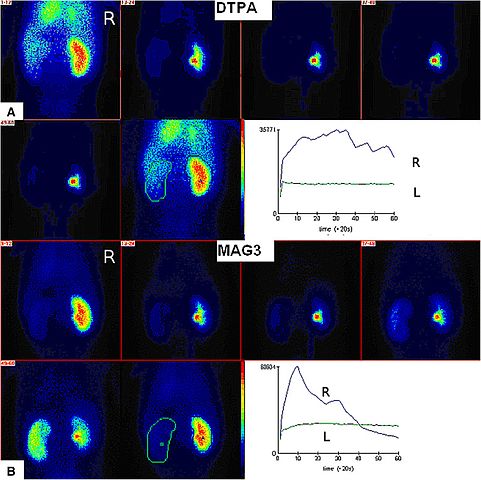 13/Unlike X-ray methods, Nuclear Medicine diagnostic images can show the body’s physiology working, e.g. kidney function, bone growth