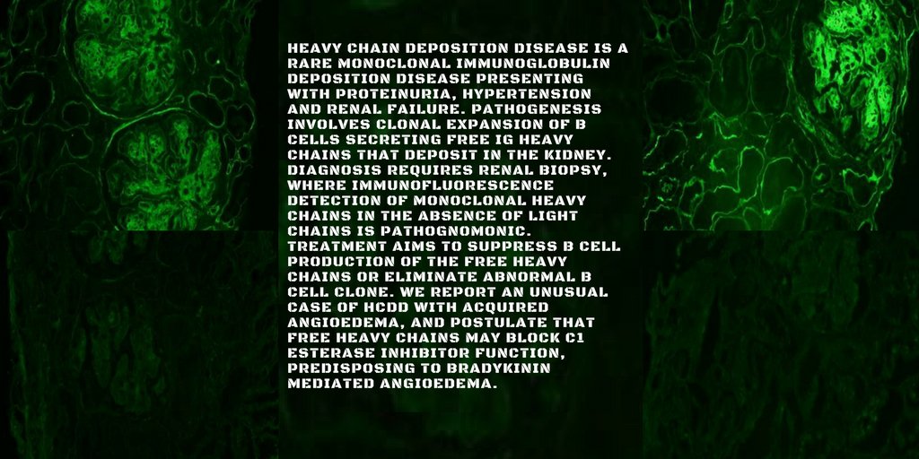 pathobiology11's tweet photo. Read about A #case of #heavychain deposition #disease complicated by acquired #Angioedema at https://t.co/31cIg0Wtp7 https://t.co/3fZOb0Ik4e