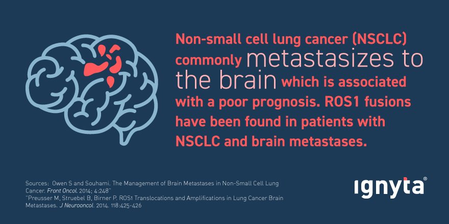 Ignyta's tweet photo. Metastatic lesions to the #brain most commonly stem from #LungCancer. CNS-active treatments are urgently needed. #NSCLC #LCAM https://t.co/X2ZPj3GyGN