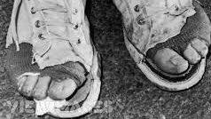 LGomezcala's tweet photo. Too much walking. My feet are killing me at #websummit. Doesn't anyone has a startup to bring me relief ?@CoimbraSummit #feet #noPainNoGain https://t.co/DdY1MLZAj9