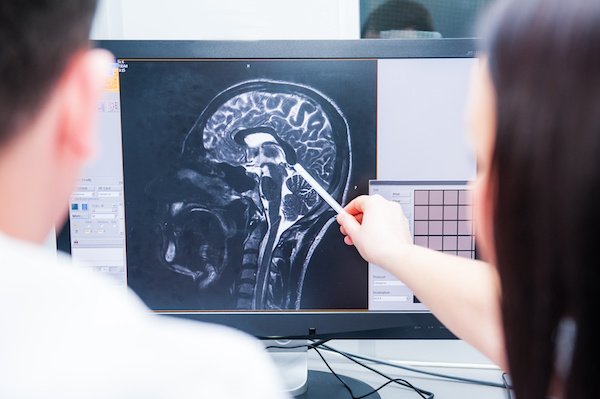 openmrict's tweet photo. A dark spot can appear on #medical #imaging scans for several reasons.  

Learn more: https://t.co/xrfi2PrHZE   

#Wellness #MRI #CTHealth https://t.co/dJMoBmQfti