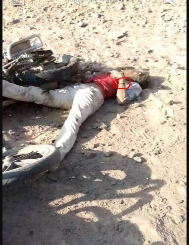 HouthisDead's tweet photo. @Moh_Alhouthi هل تستطيع شرح لماذا توجد سلسلة المقاتل العسكري في يده؟ انتهى زمن التضليل وبدأ زمن التنظيف https://t.co/V0QGIDOhnF