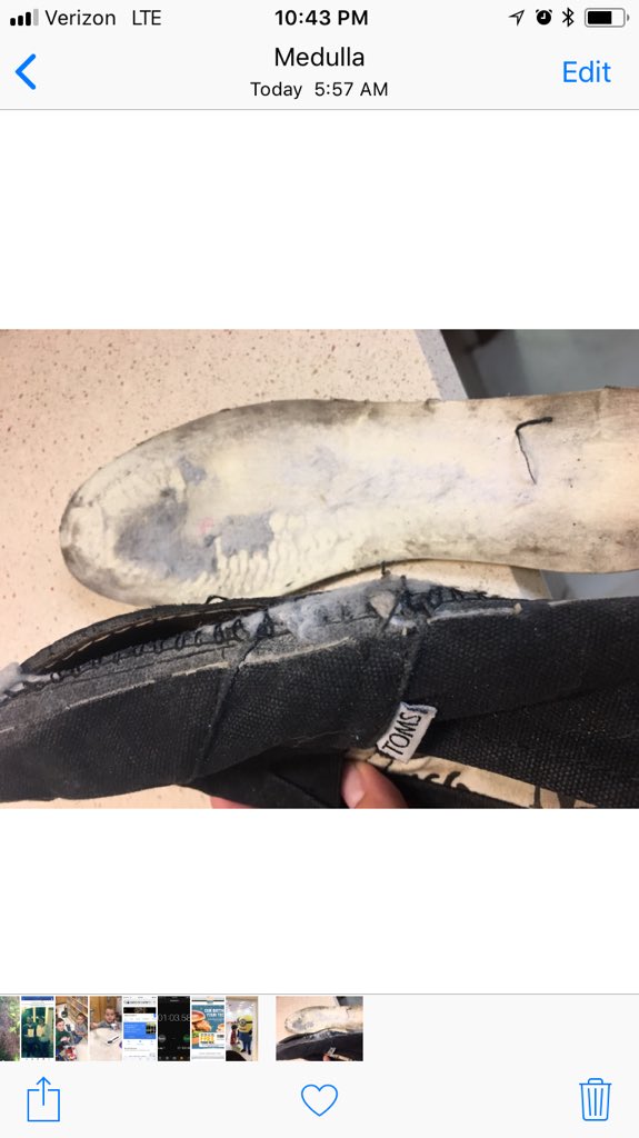 ShariBurkey's tweet photo. @TOMS Why would this happen https://t.co/b6DkYJMlZe