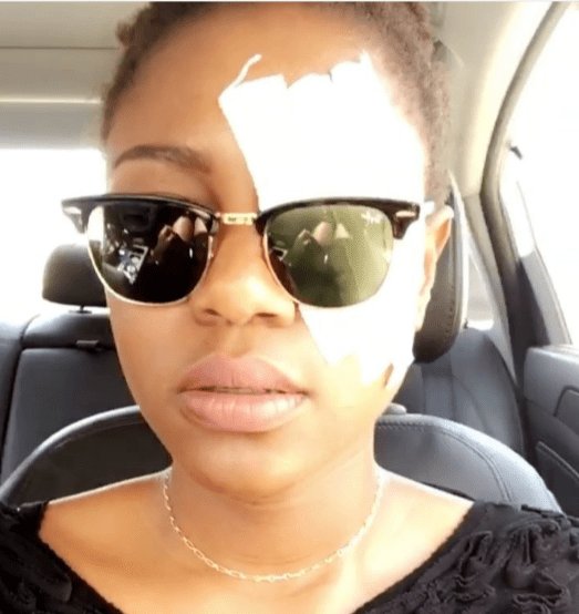 Yvonne Nelson wishes mum happy birthday with a bandaged eye  