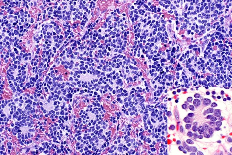 Soc. Pediatric Path. tweet media