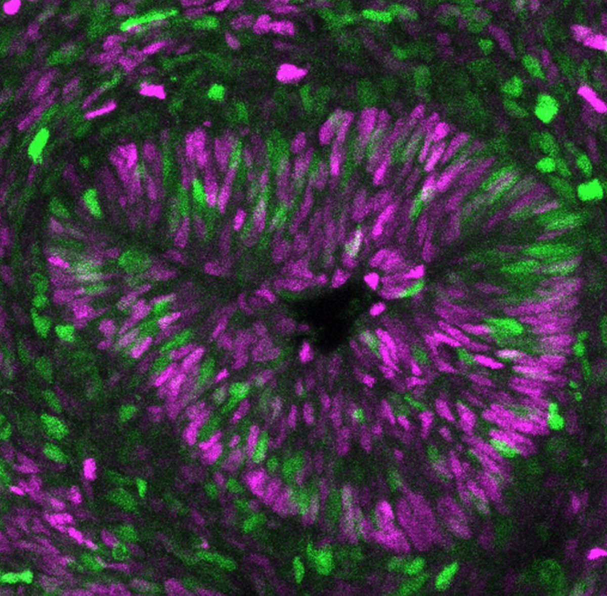 IAmSciArt's tweet photo. From #swsdb17: Developing Mouse Intestine Labelled with Fucci Cell Cycle Reporter. By Anthony Barrasso from the Poché Lab at @bcmhouston https://t.co/Ir7ww4YQH1