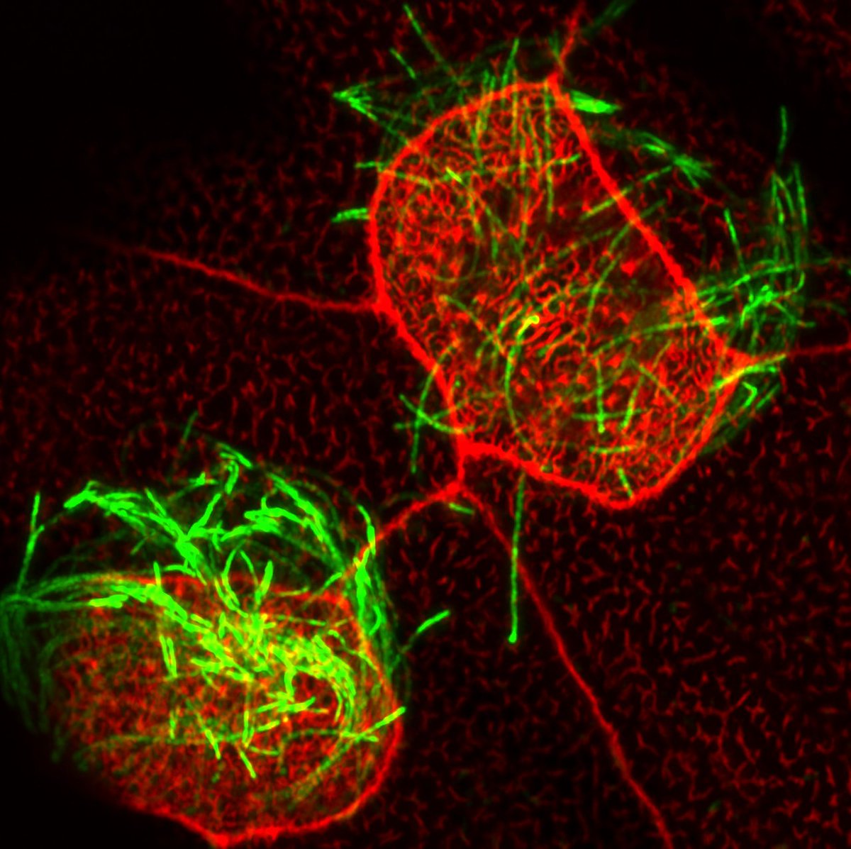 IAmSciArt's tweet photo. Last #swsdb17 for today: multi ciliated cells in Xenopus laevis embryonic skin.
By Vanja Stannic from the Miller Lab at @McGovernMed https://t.co/ANZ6PX27Iv