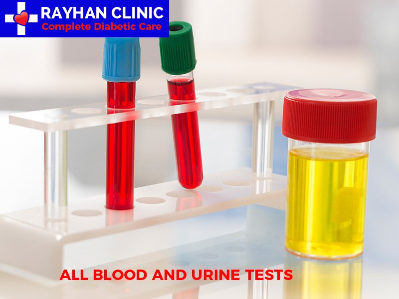 rayhanclinic's tweet photo. Blood drug tests are accurate and virtually impossible to beat.
https://t.co/UT3SmVzVlB
#diabetes #diabetic #diabetesclinic #diabeticfootcare #bloodglucose #diabetesconsultation #diabeteseducation #ecg #generalconsultation https://t.co/pLabEwoPVk