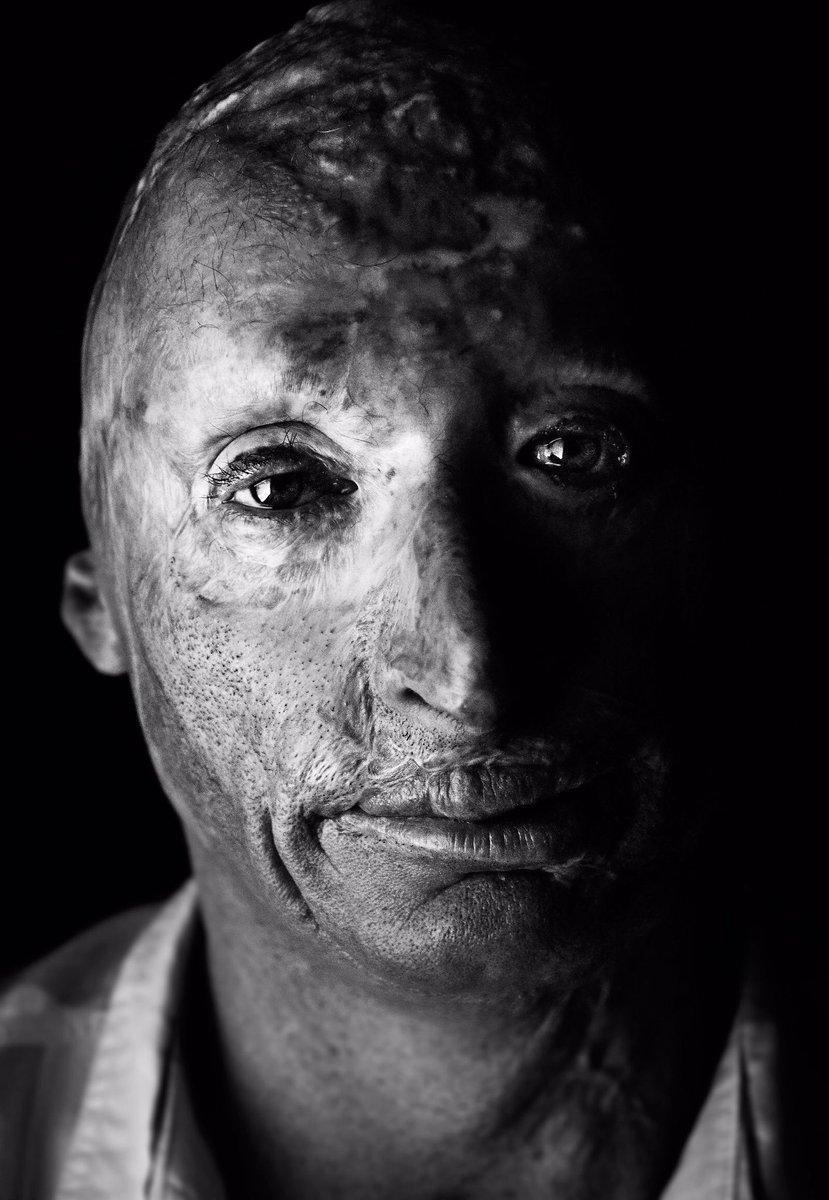 A Hero, Army SSG (Ret) <a href="/BobbyHenline/">Bobby Henline</a> #MyArmyContest @NatGeoChannel